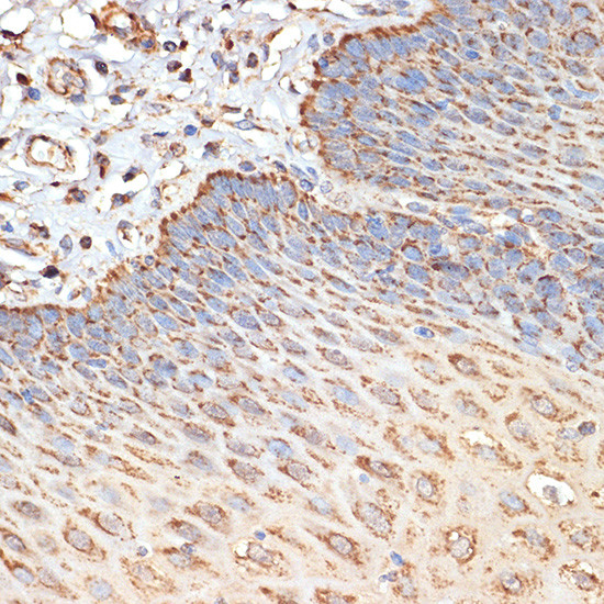 TSC2 Antibody in Immunohistochemistry (Paraffin) (IHC (P))