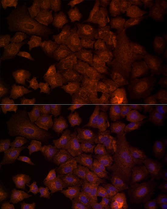 NRG1 Antibody in Immunocytochemistry (ICC/IF)