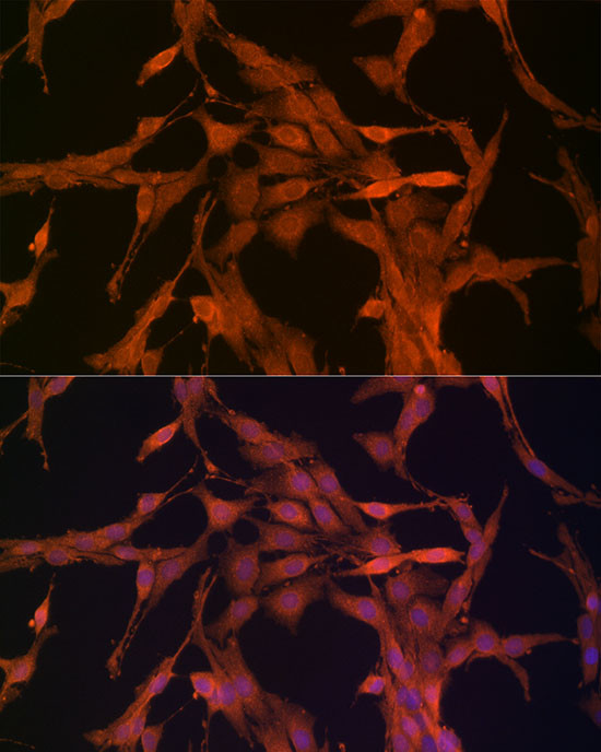 NRG1 Antibody in Immunocytochemistry (ICC/IF)