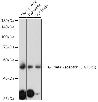 TGFBR1 Antibody in Western Blot (WB)