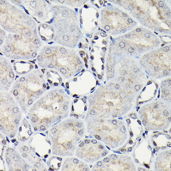 C/EBP beta Antibody in Immunohistochemistry (Paraffin) (IHC (P))