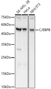 C/EBP beta Antibody in Western Blot (WB)