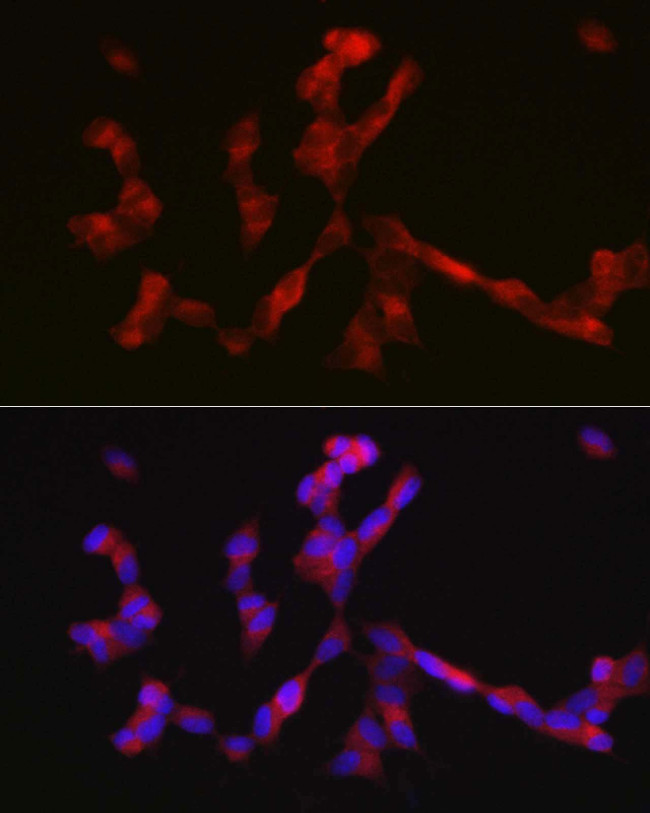 ALK Antibody in Immunocytochemistry (ICC/IF)