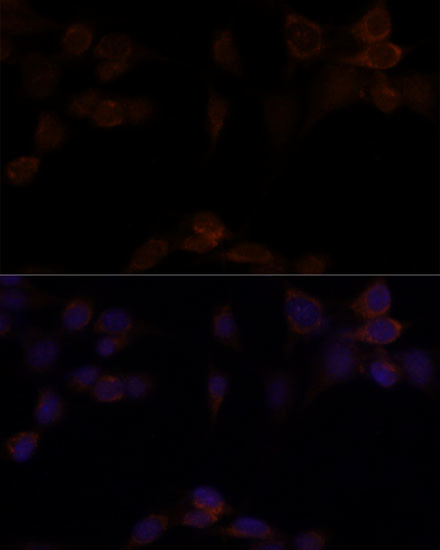 YAP1 Antibody in Immunocytochemistry (ICC/IF)