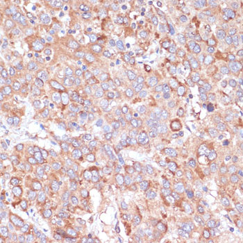 YAP1 Antibody in Immunohistochemistry (Paraffin) (IHC (P))