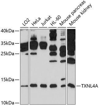 TXNL4A Antibody in Western Blot (WB)