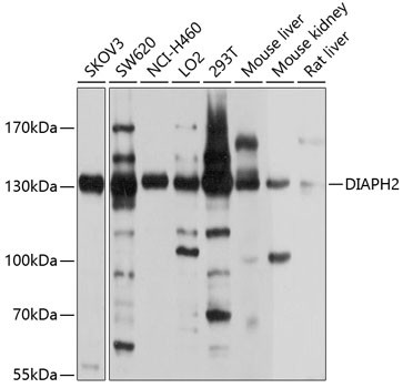 DIAPH2 Antibody in Western Blot (WB)