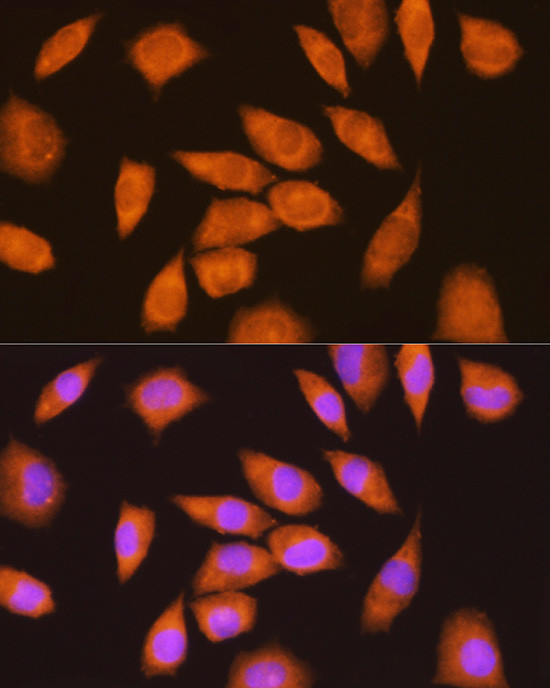 Ly-6E Antibody in Immunocytochemistry (ICC/IF)