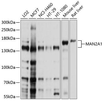 MAN2A1 Antibody in Western Blot (WB)