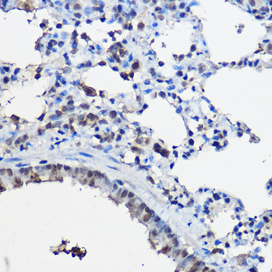 SRC2 Antibody in Immunohistochemistry (Paraffin) (IHC (P))