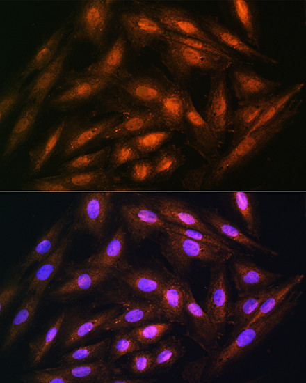 DUSP14 Antibody in Immunocytochemistry (ICC/IF)