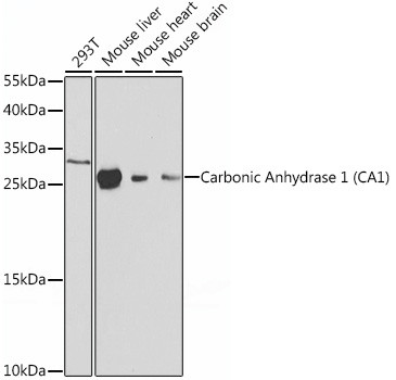 Carbonic Anhydrase I Antibody in Western Blot (WB)