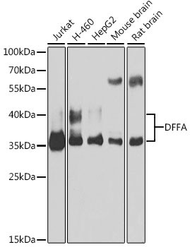 ICAD Antibody in Western Blot (WB)