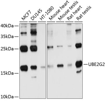 UBE2G2 Antibody in Western Blot (WB)