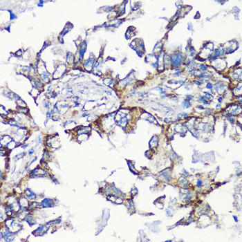 MMP16 Antibody in Immunohistochemistry (Paraffin) (IHC (P))