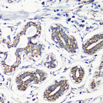 MMP16 Antibody in Immunohistochemistry (Paraffin) (IHC (P))