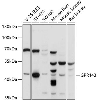 GPR143 Antibody in Western Blot (WB)