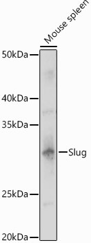 SLUG Antibody in Western Blot (WB)