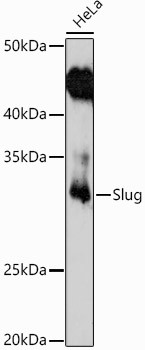 SLUG Antibody in Western Blot (WB)