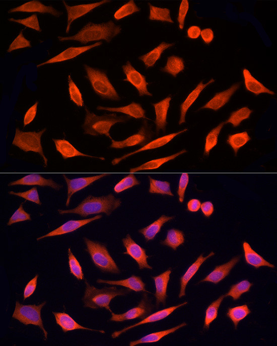 MST3 Antibody in Immunocytochemistry (ICC/IF)