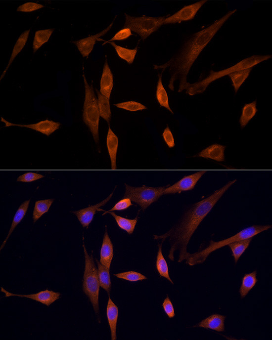 MST3 Antibody in Immunocytochemistry (ICC/IF)