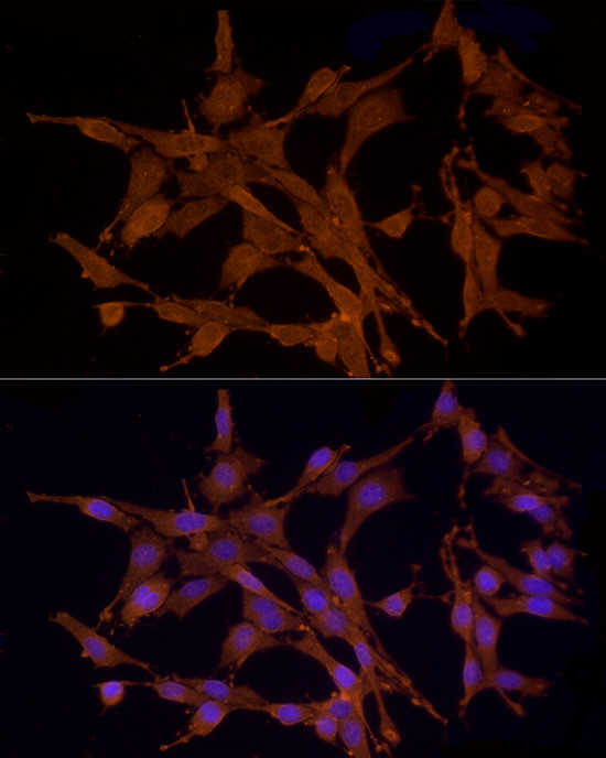 MST3 Antibody in Immunocytochemistry (ICC/IF)