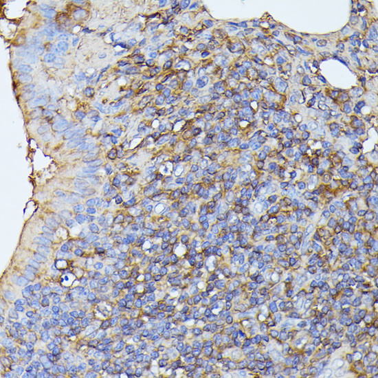 MST3 Antibody in Immunohistochemistry (Paraffin) (IHC (P))