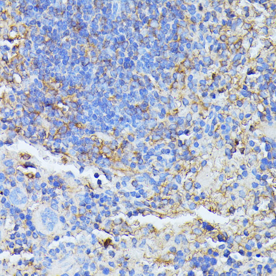 MST3 Antibody in Immunohistochemistry (Paraffin) (IHC (P))