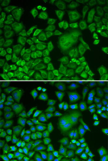 Arp3 Antibody in Immunocytochemistry (ICC/IF)