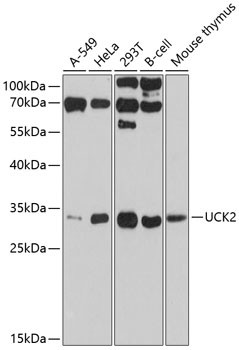 UCK2 Antibody in Western Blot (WB)