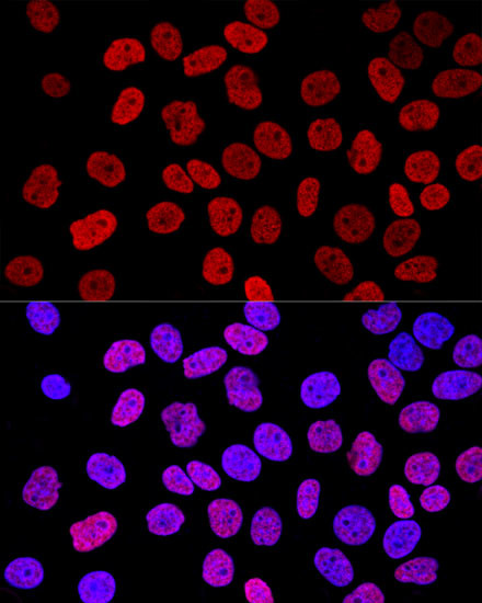 Histone H2A.X Antibody in Immunocytochemistry (ICC/IF)