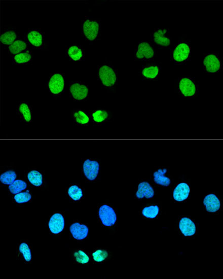 Histone H2A.X Antibody in Immunocytochemistry (ICC/IF)