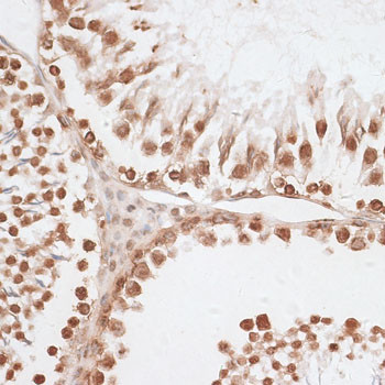 Histone H2A.X Antibody in Immunohistochemistry (Paraffin) (IHC (P))