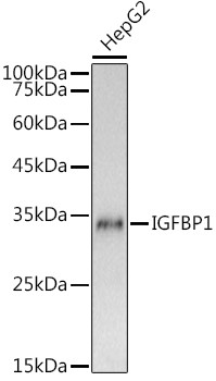 IGFBP-1 Antibody in Western Blot (WB)