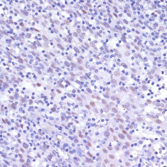 NFkB p50/p105 Antibody in Immunohistochemistry (Paraffin) (IHC (P))