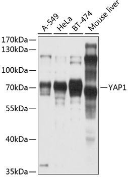 YAP1 Antibody in Western Blot (WB)