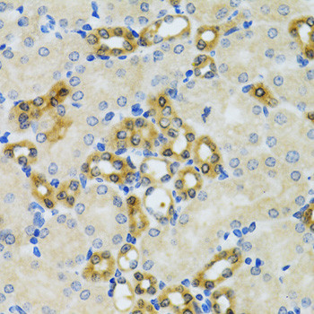 PHPT1 Antibody in Immunohistochemistry (Paraffin) (IHC (P))