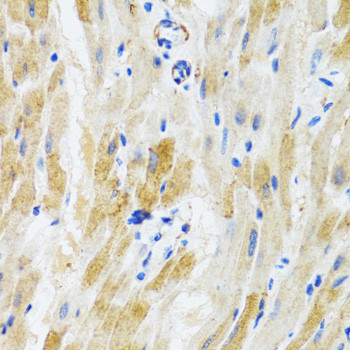 PHPT1 Antibody in Immunohistochemistry (Paraffin) (IHC (P))