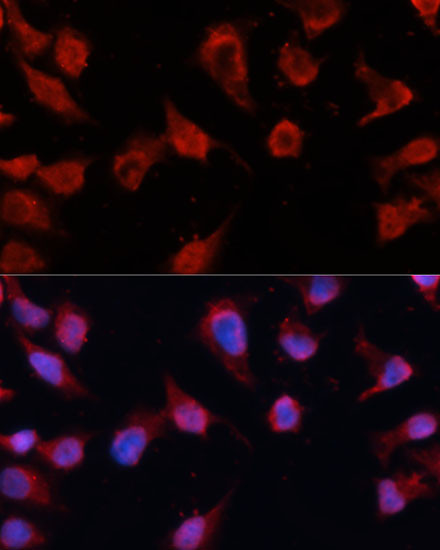 Caspase 8 Antibody in Immunocytochemistry (ICC/IF)