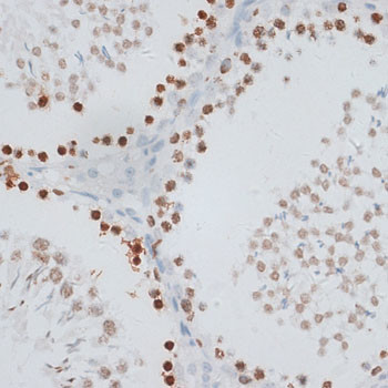 Histone H2A.X Antibody in Immunohistochemistry (Paraffin) (IHC (P))