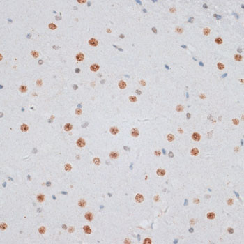 Histone H2A.X Antibody in Immunohistochemistry (Paraffin) (IHC (P))