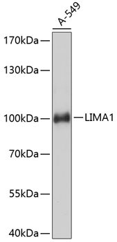 EPLIN Antibody in Western Blot (WB)