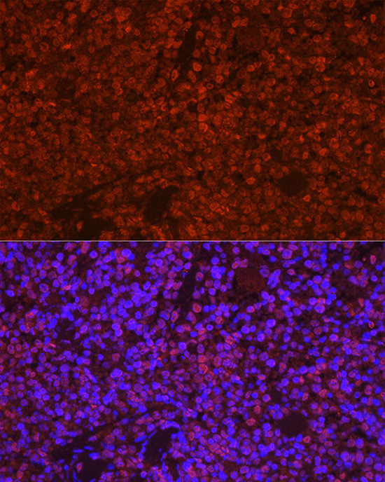 PYCARD Antibody in Immunocytochemistry (ICC/IF)