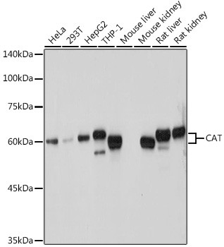 Catalase Antibody in Western Blot (WB)