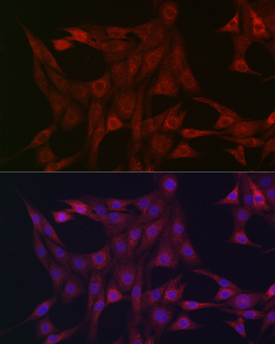 STAT3 Antibody in Immunocytochemistry (ICC/IF)