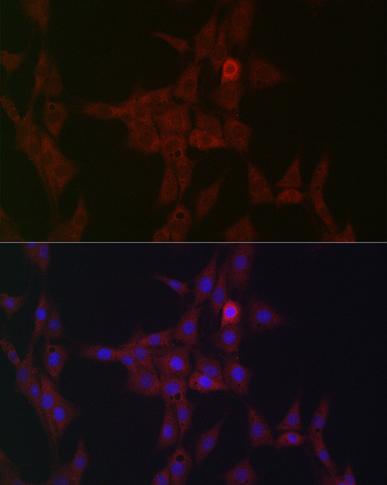 STAT3 Antibody in Immunocytochemistry (ICC/IF)