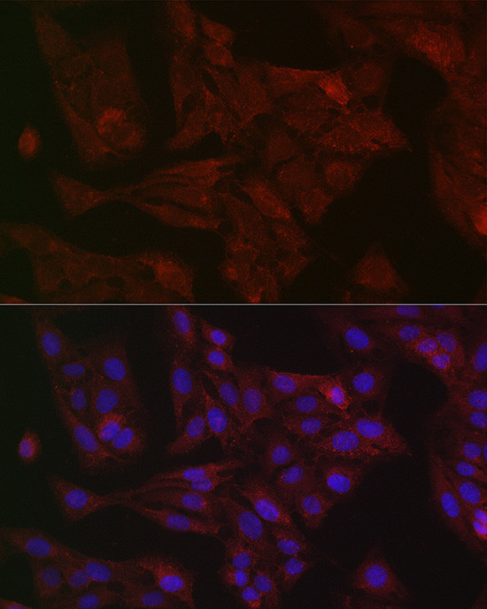 STAT3 Antibody in Immunocytochemistry (ICC/IF)