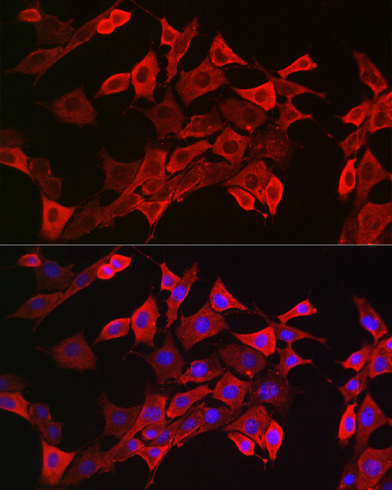 STAT3 Antibody in Immunocytochemistry (ICC/IF)