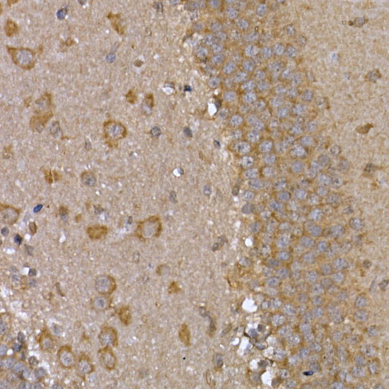 STAT3 Antibody in Immunohistochemistry (Paraffin) (IHC (P))