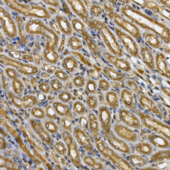 STAT3 Antibody in Immunohistochemistry (Paraffin) (IHC (P))